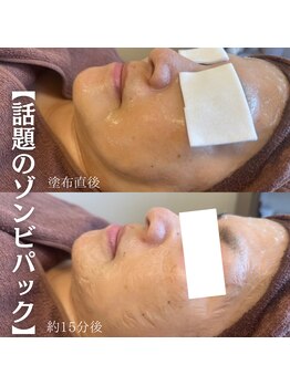 てづか整骨院 美咲が丘院/【サロン】ゾンビパック