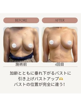 ママニエ(ma maniere)/バストアップ