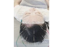 経堂鍼灸整体院