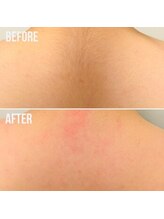 メローワックス 松本駅前店(MELLOW WAX)/手の届かない所もお任せください