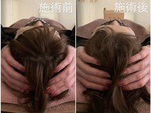 鍼灸サロン アヤカ(AYAKA)/~快眠ヘッドマッサージ~