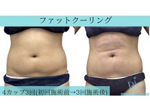 リメイク 広尾(REMAKE)/