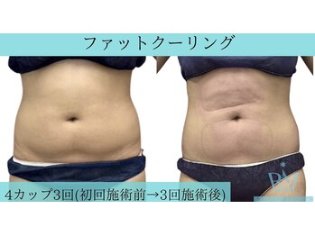 リメイク 広尾(REMAKE)/