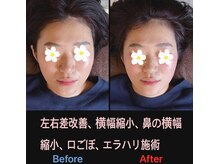 美容矯正サロン レレポノ(LELEPONO)/