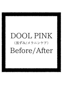 クリアボックス(Clear box)/【DOOL PINK】1月よりメニュー化