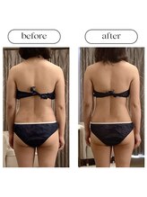 スラン(Slan)/ビフォーアフター/3ヶ月