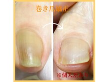 プラスキュア 用賀店(+CURE)