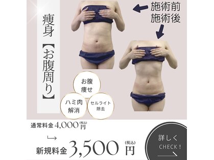 トータルエステサロン Simplese 住道の写真