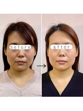 横浜DRT矯正院/小顔・美顔矯正