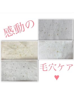 シャルム(Sharm)/毛穴の汚れ見れます♪