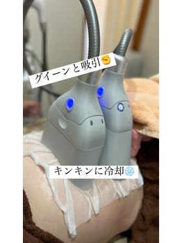 クラティス(CRATIS)/【脂肪冷却】グングン冷却!