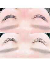 ファストラッシュ 渋谷店(FAST LASH)/VLEDLASH装着1ヶ月後/LED/まつげ