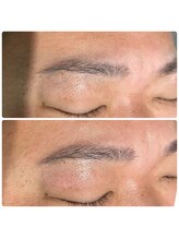 ダリア(Dahlia)/眉毛のワックス脱毛