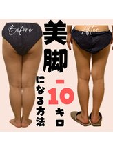 サロン ド ボーテ ラーンジュ 岐阜店(salon de beaut'e L'ange)/ハイパ-ナイフEX2ダイエット痩身