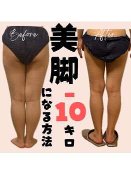 サロン ド ボーテ ラーンジュ 岐阜店(salon de beaut'e L'ange)/ハイパ-ナイフEX2ダイエット痩身