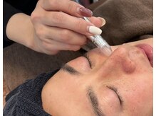 ピノ 西尾店(PINO)/【メンズフェイシャル】毛穴洗浄