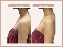 アコガレコガオ 盛岡店/