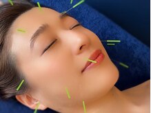 リトリート ハリ 新宿院(Re:treat HARi)