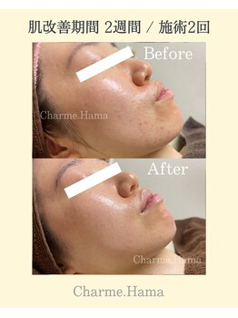 シャルム(Charme.)/オーダーメイドフェイシャル