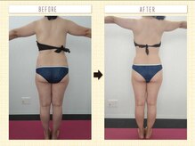 エステアンドトレーニング ビビ(ViVi)/背中・ヒップ・太もも