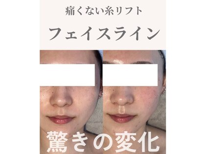 Nビューティーの写真