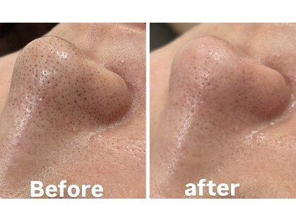 毛穴洗浄・肌質改善専門店 -SODATSU- skin salon【6/1 NEW OPEN】の写真