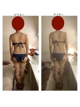 アクア エステティコ 亀有(ACQUA estetico)/ブライダル1