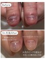 ネイル アヴァンス あべのルシアス店(Nail AVANCE.) 自分のお爪に悩まれている方も綺麗になります^_^