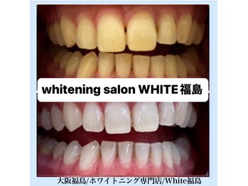 ホワイトニングサロン ホワイト(WHITE)/セルフホワイトニング/大阪/福島