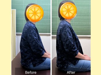 ナオル整体 春日部院(NAORU整体)/姿勢改善の【ビフォーアフター】