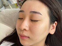 シス(sis)/眉毛&フェイシャルWAX