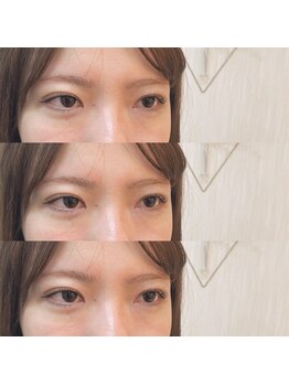 シアミス(SIAMIHS)/トリートメント