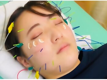 光幸はりきゅう院接骨院/美容鍼でお顔の印象UP☆浦和