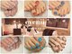 アイニー アイラッシュ アンド ネイル(eyenii)の写真/フットネイル6100円～フットのマグネットネイルは6900円～♪定番～流行まで豊富なアートで映える素足に★