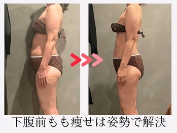 ツーアップ(2up)/下腹厚み,太もも前張り2回