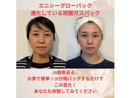 ミヨン(Miyong)の写真