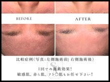 韓国肌管理室 ソア(soa)/【どんな敏感肌も任せください】