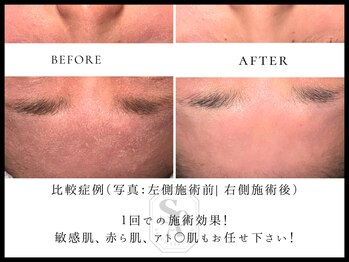 韓国肌管理室 ソア(soa)/【どんな敏感肌も任せください】