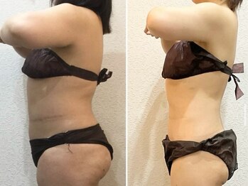 美容整体ウェリナ 名駅院/小顔矯正/骨盤矯正/美脚サロン