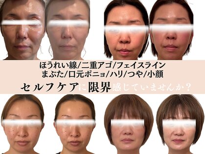 エンジェルエッグの写真