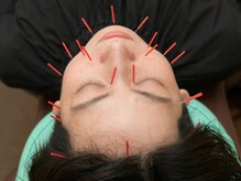 町のはりきゅう接骨院 本院/