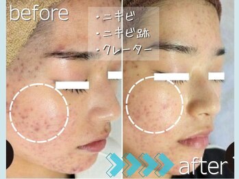 マルサンカクシカク(○△□)/