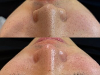 エネ ラッシュアンドブロウ バイ アンドエラ(ENNE Lash&Blow by&ERA)/グロスWax