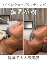 リリー(LILY)/韓国美容　LILY　