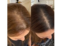 カルミア(kalmia)