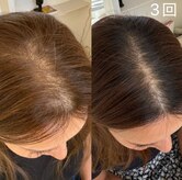 カルミア(kalmia)