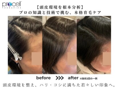 プラージュ(plage)の写真