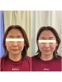 整音(totonone) 歪みによる表情筋低下、むくみ、たるみ、骨格矯正で根本改善
