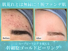 リメイクビューティークリニック(REMAKE BEAUTY CLINIC)の雰囲気(ピーリング成分ゼロ!健康で強い肌に作り替える肌質改善術)