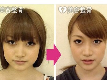 雨の音の写真/【小顔の鍵は身体】土台である身体の歪みから整え、むくみ・左右差すっきり｜小顔矯正＋美容整体￥9,800